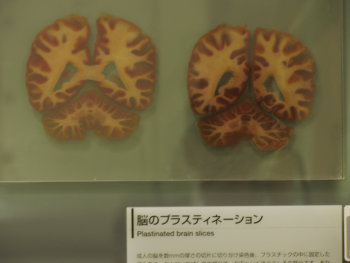 ファイル名: blog20070205HumanBrainSlice.jpeg
ファイルサイズ: 17.1KB Human brain slice