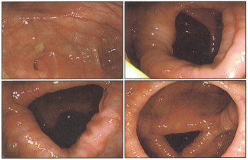 ファイル名: blog20070512-intestine.jpeg
ファイルサイズ: 28.7KB blog20070512-intestine